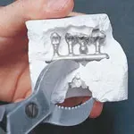 مستهلكات الصب التقليدية